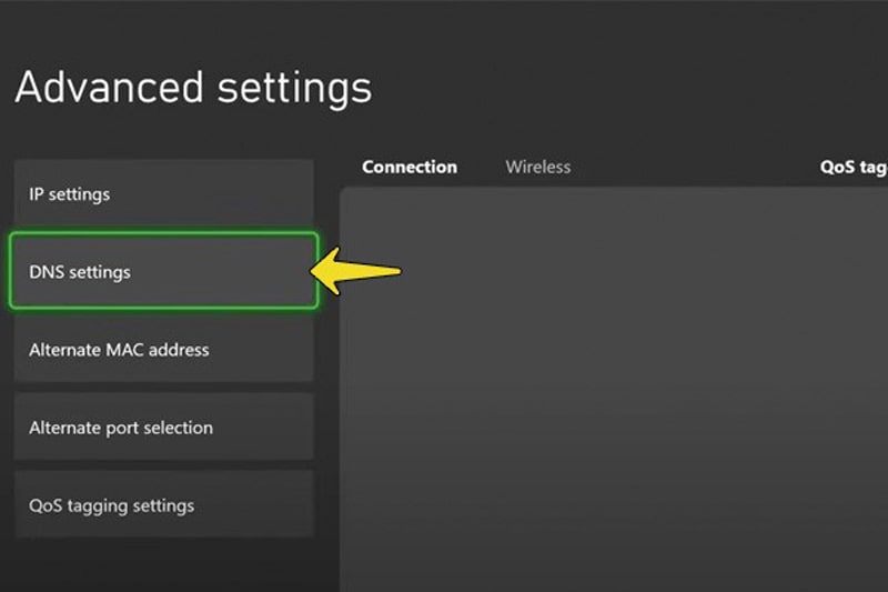 تنظیم DNS کنسول ایکس باکس 